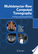 Multidetector-row computed tomography : scanning and contrast protocols /