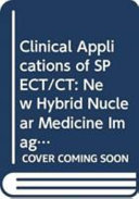 Clinical applications of SPECT/CT : new hybrid nuclear medicine imaging system.