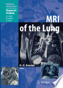 MRI of the Lung /