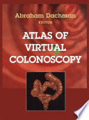 Atlas of virtual colonoscopy /