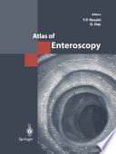 Atlas of enteroscopy /