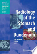 Radiology of the stomach and duodenum /