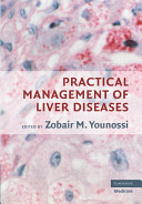 Practical management of liver diseases /