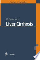 Liver cirrhosis /