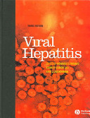 Viral hepatitis /