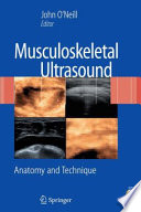 Musculoskeletal ultrasound : anatomy and technique /