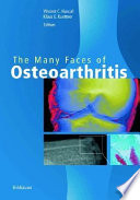 The many faces of osteoarthritis /