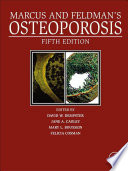 Marcus and Feldman's osteoporosis /