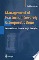 Management of fractures in severely osteoporotic bone : orthopedic and pharmacologic strategies /