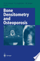 Bone densitometry and osteoporosis /