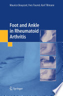 Foot and ankle in rheumatoid arthritis /