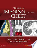 Müller's imaging of the chest /