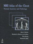 MRI atlas of the chest : normal anatomy and pathology /