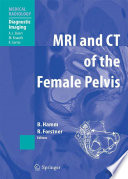 MRI and CT of the female pelvis /