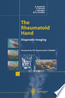 The rheumatoid hand : diagnostic imaging /