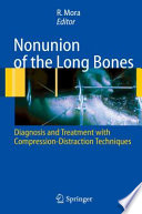 Nonunion of the long bones : diagnosis and treatment with compression-distraction techniques /