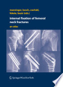 Internal fixation of femoral neck fractures : an atlas /