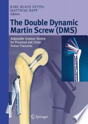 The double dynamic Martin screw (DMS) : adjustable implant system for proximal and distal femur fractures /