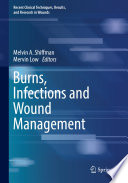 Burns, Infections and Wound Management /