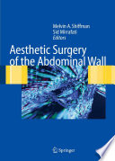 Aesthetic surgery of the abdominal wall /