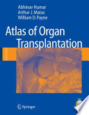 Atlas of organ transplantation /