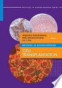 Methods in bioengineering : cell transplantation /