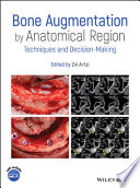 Bone augmentation by anatomical region : techniques and decision-making /