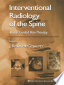 Interventional radiology of the spine : image-guided pain therapy /