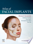 Atlas of facial implants /