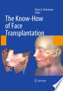 The know-how of face transplantation /