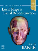 Local flaps in facial reconstruction /
