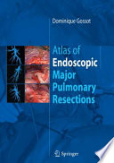 Atlas of endoscopic major pulmonary resections /