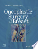 Oncoplastic surgery of the breast /