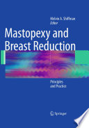 Mastopexy and breast reduction : principles and practice /