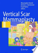 Vertical scar mammaplasty /