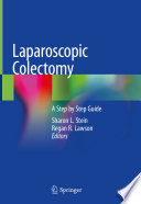 Laparoscopic Colectomy : A Step by Step Guide /