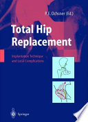 Total hip replacement : implantation technique and local complications /
