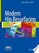 Modern hip resurfacing /