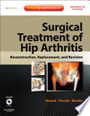 Surgical treatment of hip arthritis : reconstruction, replacement, and revision /