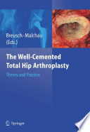 The well-cemented total hip arthroplasty : theroy and practice /