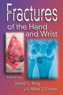 Fractures of the hand and wrist /