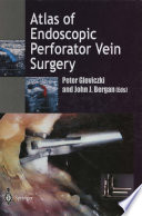 Atlas of endoscopic perforator vein surgery /