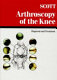 Arthroscopy of the knee : diagnosis and treatment /
