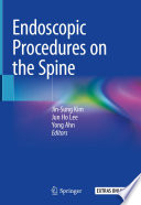 Endoscopic Procedures on the Spine /