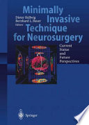 Minimally invasive techniques for neurosurgery : current status and future perspectives /