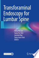 Transforaminal Endoscopy for Lumbar Spine /