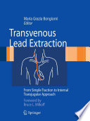 Transvenous lead extraction : from simple traction to internal transjugular approach /