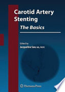 Carotid artery stenting : the basics : how to set up and maintain a cath lab /