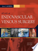 Atlas of endovascular venous surgery /