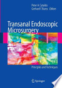 Transanal endoscopic microsurgery : principles and techniques /